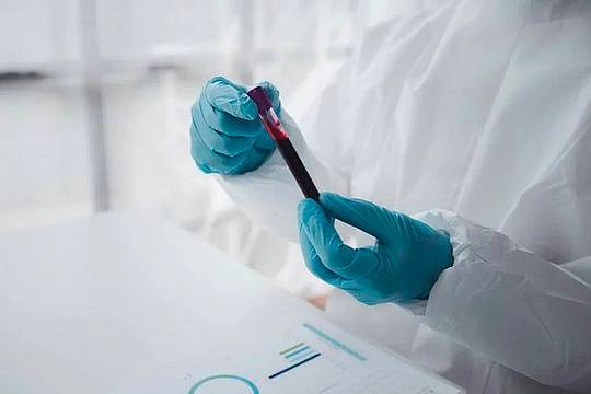Provetta per analisi del sangue - 123 Rf