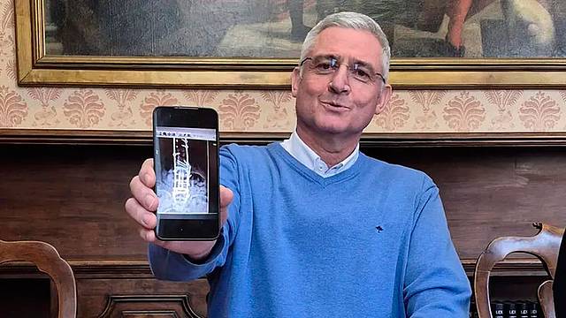 De Pellegrin mostra la radiografia della sua schiena